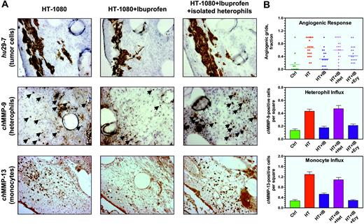 Figure 6. Modulation of angiogenesis in HT-1080 onplants: inhibition of inflammatory cell influx by ibuprofen and its rescue by exogenous heterophils. (A) Collagen onplants containing 5 × 104 HT-1080 cells were incubated on the CAM of nontreated embryos (left panels) or embryos treated systemically with ibuprofen (middle and right panels). In addition, a subset of ibuprofen-treated embryos was engrafted with HT-1080 onplants containing 5 × 104 purified heterophils isolated from peripheral blood (right panels). At 72 hours, onplants were harvested and frozen in OCT compound or fixed in formalin. Cryosections were immunohistochemically stained with mAb 29-7 to visualize human cells (top panels) or chMMP-9–specific antibody to visualize heterophils (arrows, middle panels). Paraffin-embedded sections were immunohistochemically stained with chMMP-13–specific antibody to visualize monocytes/macrophages as brown rounded cells (bottom panels). (B) Angiogenic response and the heterophil and monocyte influxes were scored at 72 hours in control onplants (ctrl) and onplants containing 5 × 104 HT-1080 cells (HT), which were placed on nontreated embryos or embryos systemically treated with ibuprofen (IB). Isolated heterophils (Het) or erythrocytes (Ery) were added at a concentration of 5 × 104 cells per onplant to the 2 subsets of HT-1080 onplants grafted on the CAM of ibuprofen-treated embryos. Angiogenic response was determined as a fraction of onplant grids containing the newly formed blood vessels (top graph; bar indicates mean). Influx of heterophils was determined as a tissue density of chMMP-9–positive cells scored in × 20 tissue images (middle graph). Influx of monocytes was determined as a tissue density of chMMP-13–positive cells scored in × 20 tissue images (bottom graph). Data are presented as the mean ± SEM. Shown is a representative of 3 independent experiments. Statistical significance was confirmed (P < .05) for each variable in comparison with the previous experimental group as depicted in the scatter and bar graphs.