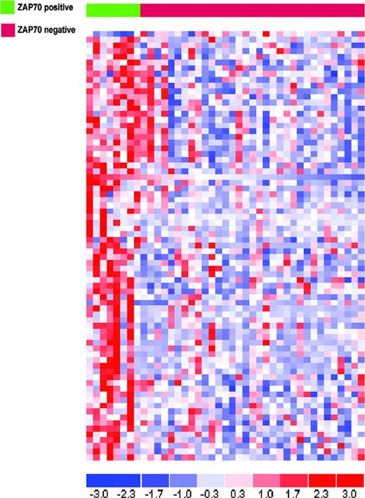 Figure 5. Comparative analysis between high-versus low-expressing ZAP70 samples that did not carry any known molecular abnormalities. The analysis was performed using an ANOVA and led to the selection of 75 probe sets. Blue indicates low expression; red, high expression.