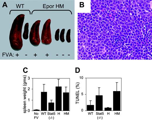 Figure 1. The distal EPOR and STAT5 are not required for Friend virus-induced erythroblastosis. (A) Photograph of spleens from FVA-infected mice. Mouse strains are indicated at the top. Infection with Friend virus is indicated at the bottom (FVA). (B) Photomicrograph of spleen from Friend virus-infected EporHM mouse, stained with hematoxylin and eosin. Original magnification × 400. (C) Spleen weights of FVA-infected mice in grams. The mouse strains are indicated at the bottom. Stat5 (-/-) denotes the Stat5a-/-;Stat5b-/- strain. The spleen weights of uninfected mice are provided as a control (no FV). Error bars represent standard deviation (Stat5 (-/-), EporH, EporHM, P < .001). (D) Percent transferase-mediated deoxyuridine triphosphate nick-end labeling (TUNEL)-positive cells in the spleens of FVA-infected mice (Stat5 (-/-), P = .07; EporH, P > .10; EporHM, P = .10).