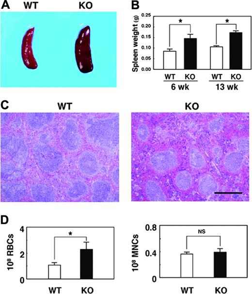 Figure 2. Macroscopic and microscopic analyses of the spleen of SHPS-1 mutant mice. (A) Spleens of WT and homozygous SHPS-1 mutant (KO) mice at 7 weeks of age. (B) Weight of the spleen of WT and SHPS-1 mutant mice at 6 or 13 weeks of age. Data are means ± SE of values from 5 mice of each group. *P < .05. (C) The spleen of WT or SHPS-1 mutant mice at 6 weeks of age was fixed and stained with Mayer hematoxylin-eosin. Data are representative of 3 independent experiments. Scale bar, 0.5 mm. Images were visualized using a BX50 microscope equipped with a 4×/0.16 objective lens (Olympus), captured with a DP70 camera (Olympus) and analyzed with Adobe Photoshop 8.0 software (Adobe Systems). (D) The numbers of RBCs and mononuclear cells (MNCs) in the spleen of WT or SHPS-1 mutant mice at 6 weeks of age were counted. Data are means ± SE of values from 5 mice of each genotype. NS indicates not significant; *P < .05.