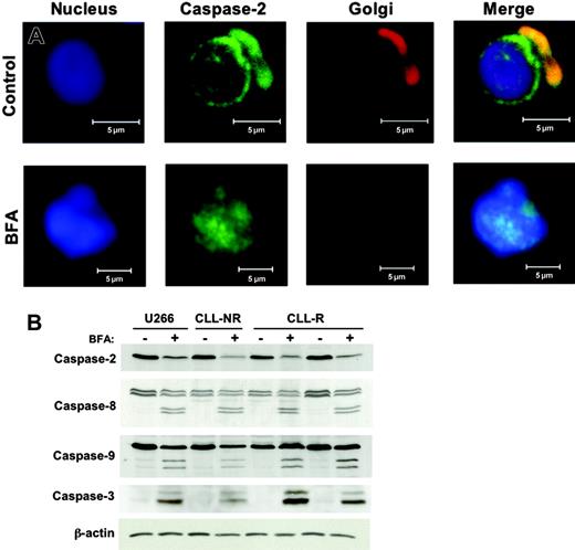 Figure 3. Activation of multiple caspases by brefeldin A. (A) Caspase-2 is localized to the Golgi apparatus and nuclear membrane in primary CLL cells. Control and brefeldin A-treated (100 ng/mL, 24h) B-CLL cells were cytocentrifuged onto glass slides, fixed, and stained with a monoclonal human anti-caspase-2 antibody and markers for the nucleus (To-Pro-3) and Golgi apparatus (BODIPY-TR-Ceramide). Subcellular localization of caspase-2 was visualized by confocal microscopy using an LSM 510 confocal microscope with a Plan-Neofluar dry 40 ×/0.75 objective lens and a built-in camera (Carl Zeiss, Thornwood, NY). (B) BFA treatment leads to activation of caspases-2, -8, -9, and -3. Lysates were prepared from cells with or without 100 ng/mL BFA treatment for 24 hours. Western blotting was used to evaluate the indicated caspases in primary CLL cells and U266 cells. The antibody used for caspase-3 recognizes the cleaved (active) form only. Actin was used as a loading control. NR = nonrefractory; R = fludarabine refractory.