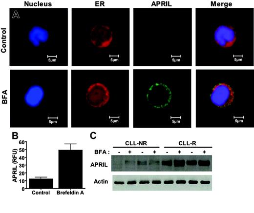 Figure 6. Induction of APRIL accumulation in the ER of B-CLL cells following brefeldin A treatment. (A) APRIL accumulates in the ER following treatment with brefeldin A. Primary CLL cells were treated with 100 ng/mL BFA for 24 hours. Following drug treatment, cells were cytocentrifuged onto glass slides and fixed as described in “Patients, materials, and methods.” Cells were stained with a monoclonal anti-APRIL antibody and markers for the ER (calreticulin) and nucleus (To-Pro-3). APRIL immunofluorescence was visualized by confocal microscopy. Images were obtained as for Figure 3A. (B) Quantitation of the BFA-induced increase in APRIL immunofluorescence. The intensity of fluorescence was quantitated using Optimas software as described in “Materials and methods.” n = 8 for each condition; error bars indicate the SD. (C) Brefeldin A causes an increase in the intracellular levels of the APRIL protein. Primary CLL cells were treated with 100 ng/mL BFA for 24 hours. Lysates from control and drug-treated cells were electrophoresed, and APRIL levels were assayed by immunoblotting with an APRIL-specific antibody. Actin was used as a loading control. NR = nonrefractory; R = refractory.