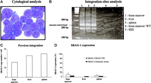 Figure 7. Characteristics of the severe adverse effect observed in one mouse after RAG1 gene transfer. Six months after primary transplantation, a mouse moving slower and weighing less than its littermates was killed. (A) Cytologic analysis was performed on spleen cells. May Grünwald-Giemsa staining was performed on cytospin slides. Images were visualized using a Leica DM:RB microscope equipped with a 40 ×/0.7 objective lens and a Leica 350F camera (Leica, Wetzlar, Germany). The total original magnification of the image is × 400. (B) LAM-PCR was performed on the DNA extracted from the enlarged organs and on bone marrow cells from a wild-type C57BL/10 mouse. (C) The hRAG1 copy number was quantified on the DNA extracted from the enlarged organs. (D) hRAG-1 expression was determined on the RNA extracted from bone marrow, liver, and spleen cells and compared with the expression in the spleen and bone marrow of the other RAG1-TM mice. hRAG-1 transcript expression was compared with endogenous acidic ribosomal phosphoprotein expression (PO) and expressed as a percentage of a reference sample (RAG-1 expression in the thymus of a wild-type mouse). Data are expressed as means plus or minus SD.