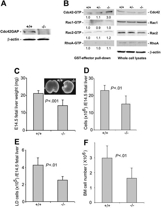 Figure 1. Genetic deletion of Cdc42GAP and effects on Rho GTPase activities in fetal liver-derived hematopoietic cells and on hematopoietic organ cellularity. (A) Low-density fetal liver cells from WT (+/+) or homozygous (-/-) mice were immunoblotted with anti-Cdc42GAP monoclonal antibody for the detection of Cdc42GAP expression. (B) Low-density cells from E14.5 fetal livers of WT, heterozygous, or homozygous mice were subjected to effector domain pull-down assays, and the activities of Cdc42, Rac1, Rac2 (detected by GST-PAK1), and RhoA (detected by GST-Rhotekin) were examined and compared in the anti-Cdc42, Rac1, Rac2, or RhoA immunoblots. Blotting of the respective total-cell lysates was carried out in parallel. Relative amounts of GTP-bound form of the GTPases were quantified by densitometry measurements and normalized to those of the WT cells. (C-E) E14.5 embryos of WT (n = 20) or homozygous (n = 40) mice were compared for their fetal-liver weights (C), total fetal liver-cell numbers (D), and low-density fetal liver-cell numbers (E). (F) Bone marrow cell numbers from 3-day-old pups were quantified for the WT (n = 5) and homozygous (n = 5) mice.