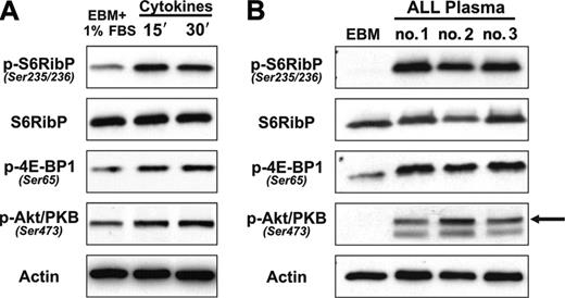 Figure 1. Cytokine and leukemia stimulation of BM-ECs triggers the mTOR pathway. Quiescent BM-ECs were stimulated and analyzed for activation of mTOR downstream substrates (S6RibP, 4E-BP1) and activation of Akt/PKB by Western blot. (A) BM-ECs cultured overnight in EBM + 1% FBS were stimulated for 15 and 30 minutes with a cocktail of proangiogenic cytokines (FGF-2, VEGF, IGF-1, and EGF). Data are representative of 2 BM-EC donors tested and 2 independent experiments. (B) Cells were cultured overnight in EBM2 and stimulated for 15 minutes with 10% vol/vol of plasma from leukemia patients. The arrow indicates the correct band. Three representative cases of 7 patients tested.