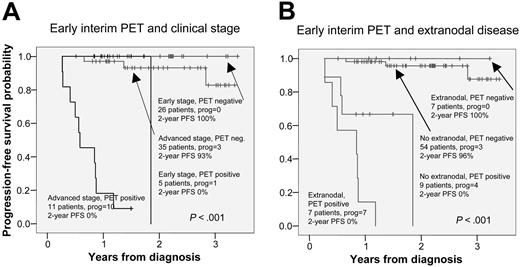 Figure 6. Progression-free survival according to early interim FDG-PET and measures of disease progression. Panel A shows clinical stage; panel B, extranodal disease.
