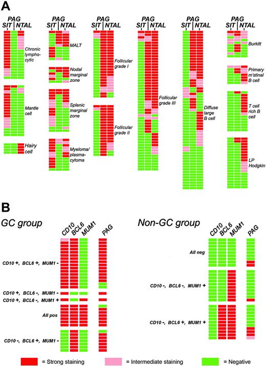 Figure 4. Schematic representation of the expression of transmembrane adaptor proteins in B-cell lymphomas. Each horizontal row represents an individual patient. (A) The expression of 3 molecules in the spectrum of B-cell lymphomas is illustrated. The majority of the cases summarized in Table 3 are included, with the exception of a small number of samples for which it was not possible (for technical reasons) to evaluate all of these markers. (B) Expression of PAG in DLBCL according to cellular origin (GC derived or non-GC). Cases were assigned to these 2 categories on the basis of immunostaining for CD10, BCL-6, and MUM1 (IRF4) following the algorithm reported by Hans et al.23
