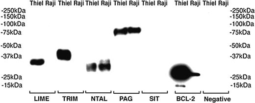 Figure 5. Western blotting of transmembrane adaptor proteins in cell lysates from Burkitt (Raji) and myeloma (Thiel) cell lines. The proteins detected with antibodies to LIME, TRIM, NTAL, and PAG have the expected molecular weights. Anti-BCL-2 is used as positive control and primary antibody was omitted in the negative control.