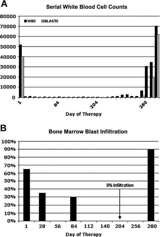 Figure 1. Clinical response and relapse in a patient (UPN1) receiving PKC412. Serial white blood cell counts (A) and percentages of bone marrow blast infiltration (B) at several time points are depicted. On day 280, the patient had a fulminant relapse while on PKC412 treatment. Bone marrow aspiration was performed on days 1, 28, 84, 204, and 280.
