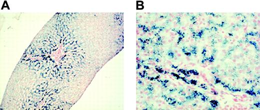 Figure 1. Micrographs of liver biopsy sample showing the entity and the distribution of iron. Staining technique: Perl Prussian blue. (A) The liver has normal architecture. Iron is heavily distributed in zone 1, whereas zone 2 appears less loaded. Original magnification, × 25. (B) Most hepatocytes were massively loaded by hemosiderin (Sciot grading 3) and by Kupffer cells to a minor extent (Sciot grading 2). Original magnification, × 200. Images were observed using an Axioplan 2 microscope (Zeiss, Göttingen, Germany) and Plan-Apochromat 4×/0.10 numeric aperture (NA) and 20×/0.40 NA objectives. Images were captured using a Nikon Coolpix 950 (Nikon, Melville, NY), and processed with ACDsee version 6.0 software (ACD Systems, Saanichton, BC, Canada).