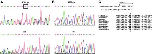 Figure 2. Identification of the DMT1 mutations in the proband. (A) Partial sequence of intron 4-exon 5 junction of the proband and wild-type (WT) DNA identifying the c.310-3_5del CTT mutation (underlined). The abnormality in the consensus sequence of the acceptor splice site is shown on the right. The dinucleotide acceptor site is in bold. (B) Sequence analysis of the DNA region encompassing exon 13 showing the heterozygous C>T transition at position 1246, causing a p. R416C mutation. (C) ClustalW alignment of the amino acid sequences of NRAMP2 (DMT1) and NRAMP1 orthologs from different species, showing complete conservativeness of the R416 residue (boxed).