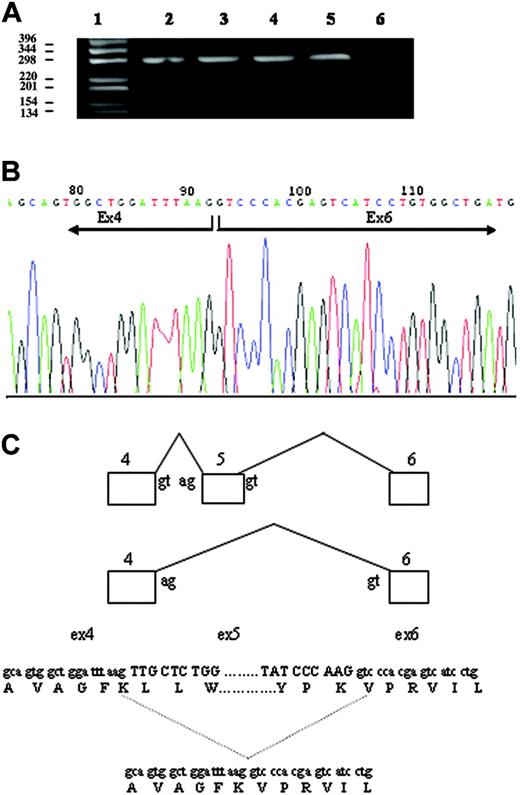 Figure 3. Analysis of the effect of c.310-3_5del CTT deletion. (A) Amplification of the exon 4-6 region of DMT1 mRNA from whole blood. cDNA was synthesized as described in “Patient, materials, and methods.” The exon 4-6 region of DMT1 cDNA was amplified by PCR, and the product was separated on 1% agarose gel. (lane 1) 1-kb DNA ladder. (lane 2) I-1. (lane 3) Proband. (lane 4) I-2. (lane 5) Healthy control. (lane 6) No template control. The top band measures 298 bp, and the bottom band in lanes 2 and 3 measures 178 bp. (B) Sequencing of PCR product of the 178-bp band (A) of II-1, resulting in exon 5 skipping and a 40 amino acid loss in the protein. (C) Schematic representation of DMT1 exon 5 skipping in the proband.