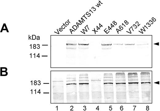 Figure 2. Expression of ADAMTS13 containing single point mutations. Conditioned medium (A) and cell lysate (B) of transfected HEK 293 cells expressing single mutant ADAMTS13 variants (abbreviations correspond to Figure 1) were normalized according to β-gal activity and analyzed by immunoblotting using an antibody against ADAMTS13 catalytic domain. The representative of at least 3 repetitive experiments is shown.