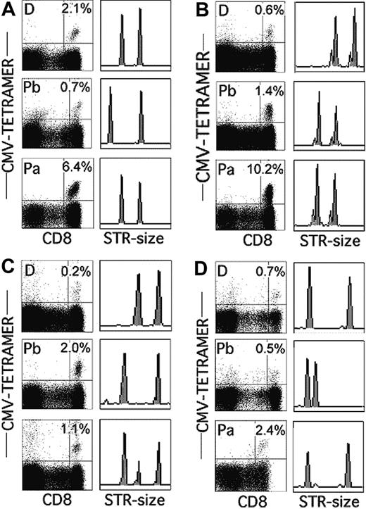 Figure 1. Percentages and origins of CMV-specific, tetramer-positive T cells in recipients of HSC grafts from CMV-positive donors 3 months after transplantation. (A) Patient 1. (B) Patient 3. (C) Patient 6. (D) Patient 10. Percentages of tetramer-positive cells in donor (D) and patient before (Pb) and after (Pa) transplantation and the corresponding STR analysis for the loci Penta E (A,D), SE33 (B), and D11S554 (C).