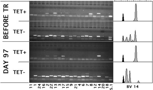 Figure 3. Many of the pretransplantation CMV-specific T-cell clones expanded after transplantation. Lanes show the PCR products of the depicted variable regions of the Vβ-chain (BVs) used by CMV-specific, tetramer-positive (TET+) and CD8+, tetramer-negative (TET-) T cells before and at day 97 after transplantation. Spectratypes of BV14, the BV of the TCR predominantly used by the tetramer-positive T cells after transplantation, are shown on the right.