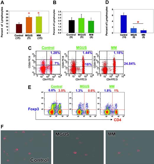 Figure 1. Characterization of Treg cells in MGUS and MM compared with healthy donors. (A) PBMCs were isolated, incubated with anti-CD4 and -CD25 antibodies, and analyzed by flow cytometry. Results are expressed as percentages of lymphocytes. Number of samples analyzed in each category is given in parentheses. *P ≤ .01 by Student t test analysis. MGUS and MM patients had significantly greater numbers of CD4+CD25+ T cells than healthy donors. (B) CD4- and CD25-expressing T cells were isolated as described in panel A, and cells expressing high levels of CD25 were then analyzed. Results are expressed as percentages of lymphocytes expressing CD4 and CD25high. Number of samples analyzed in each category is given in parentheses. No significant increases in CD4+CD25high T-cell numbers were observed in MGUS or MM patients compared with healthy donors. (C) Representative example of flow cytometry data using healthy donor cells and cells from patients with MGUS and MM. Frequency of CD25+ cells in the lymphocyte gates was analyzed using anti-CD25 PE antibody along with anti-CD4 FITC antibody. Quadrants were established using isotype controls, and stained cells were analyzed using Cytomics FC 500 (Beckman-Coulter, Fullerton, CA) and CXP software. (D) PBMCs were isolated and incubated with anti-FOXP3 antibodies (eBiosciences) for intracellular staining and then were analyzed by flow cytometry. Cells in the lymphocyte gates were used for the analysis. Results are expressed as percentages of lymphocytes expressing FOXP3, and the number of samples analyzed in each category is given in parentheses. A significantly decreased number of FOXP3+ (P < .01) Treg cells were observed in MGUS and MM patients compared with healthy donors. (E) Frequency of FOXP3+ cells in the lymphocyte gates was analyzed using anti-FOXP3 PE antibody. Dual-color analysis (PE-FOXP3 and Pc5-CD4) was optimized and used in these studies. Quadrants were established using isotype controls, and stained cells were analyzed using Cytomics FC 500 (Beckman-Coulter) and CXP software. Data are representative of 5 separate experiments. (F) PBMCs were stained with anti-FOXP3 antibodies and then analyzed using multiphoton microscopy. (BioRad MRC 1024ES multiphoton system; Bio-Rad, Hercules, CA). A Zeiss Axiovert S 100 inverted microscope equipped with a high-quality water immersion 40×/1.2 numeric aperture C-Apochromat objective was used to obtain images (total magnification is 640×). Images were reconstructed using the Bio-Rad LaserSharp and/or MetaMorph software (MetaMorph Imaging Series, Universal Imaging, West Chester, PA). Higher frequencies of stained cells were observed in PBMCs from healthy donors than in PBMCs from MGUS and MM patients. Error bars in panels A, B, and D indicate SEM.