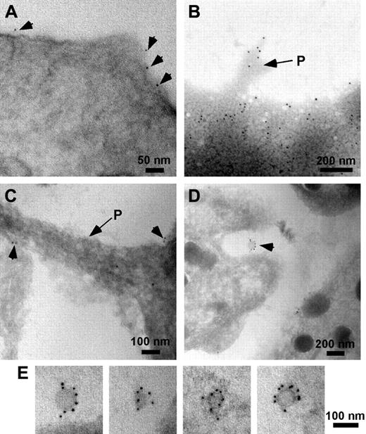 Figure 4. Immunogold labeling of resting and activated platelets. Resting and activated platelets were incubated with Abs to PrPC (308 or FL253), followed by protein G or secondary antibodies conjugated to 10 nm gold (arrowheads). In resting platelets preincubated with Ab 308 before embedding, PrPC is seen around the periphery of the cell (A). In activated platelets PrPC is found at the periphery of the cell and is associated with pseudopods (P, arrows) (B, whole mount; C, frozen section). In frozen sections of activated platelets labeled with Ab FL253, PrPC was also localized to released exosomes (seen between cells, D; and at higher magnification, E).