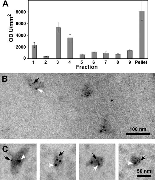 Figure 5. Immunoblotting and immunoelectron microscopy of isolated exosomes. Platelets were incubated with 1 U/mL thrombin for 120 seconds. Following termination, platelets were removed by centrifugation at 800g. Further centrifugation of the supernatant removed the microvesicles. Exosomes were isolated by differential centrifugation through a sucrose gradient. Fractions were collected from the top, and immunoblotting was carried out in each fraction using anti-PrPC Ab 308. The blots were subjected to densitometry and are expressed as mean plus or minus standard error of the mean; n = 3 (A). Fractions 3 and 4 from the sucrose gradient were adsorbed onto formvar-coated grids and double labeled with anti-PrPC Ab 308 followed by an anti-CD62 Ab (D541). The respective secondary Abs were conjugated to 5 nm (anti-PrPC; black arrows) and 10 nm (anti-CD62; white arrows) gold (B-C).