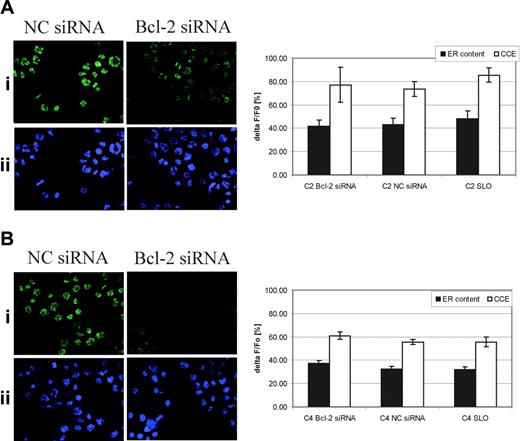 Figure 2. Effect of Bcl-2 down-regulation on levels of ER releasable calcium and CCE in Bcr-Abl–expressing cells. (A) C2 and (B) C4 cells were transfected with either a nonspecific (NC siRNA) or Bcl-2 siRNA and Bcl-2 down-regulation was shown by immunofluorescence. Cells were incubated with anti–Bcl-2 (N-19) antibody followed by an incubation with AlexaFluor-488 anti–rabbit IgG antibody (i). Nuclei were stained with Hoechst 33258 (ii). Analysis was carried out using an Olympus BX51 fluorescence microscope equipped with an FITC filter using an Olympus UPlan Fl 40 ×/0.75 objective lens. Pictures were taken using a DP70 digital microscope camera (Olympus). Olympus DP-Soft 823 version 3.2 image acquisition software was used to acquire images, which were then processed in Adobe Photoshop 7.0 software (Adobe Systems, San Jose, CA). The figure was prepared with Adobe Illustrator 10.0.3 software. ER releasable calcium was measured as described in “Materials and methods” and Figure 1 and data are shown as ΔF/F0 (%). As a negative control, cells were treated with streptolysin O only (SLO) and ER calcium content and CCE were also measured. Data of 3 independent experiments are shown (mean ± SD).