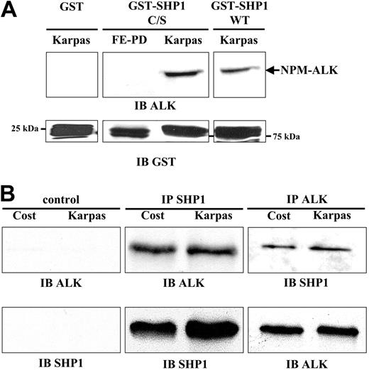 Figure 2. Association between SHP1 and NPM-ALK. (A) Pull-down experiments were performed with 5 μg of GST, GST-SHP1 C/S, or GST-SHP1 WT fusion proteins incubated with total cell extracts from 107 Karpas 299 cells (lanes 1, 3, and 4) or from 107 FE-PD cells (lane 2) pretreated with orthovanadate (500 μM for 1 h). Association of NPM-ALK with these fusion proteins was analyzed by immunoblotting with the ALKc antibody (top panel). The input recombinant proteins were detected with anti-GST antibody (bottom panel). Results are representative of 3 independent experiments. (B) Whole-cell extracts from 107 Cost or Karpas 299 cells were immunoprecipitated with anti-SHP1 antibody and immunoblotted with the ALKc antibody (top middle panel). To assess the quantity of immunoprecipitated SHP1, membranes were reprobed with anti-SHP1 antibody (bottom middle panel). NPM-ALK immunoprecipitates (using the ALK1 antibody) were subjected to immunoblotting with anti-SHP1 antibody (top right panel). Membranes were then reprobed with the ALKc antibody (bottom right panel). Immunoprecipitations were performed without addition of antibody as negative control (left panels). Data are representative of 5 independent experiments.