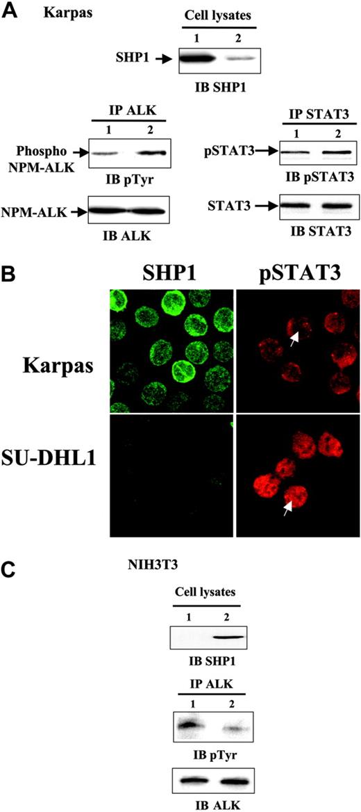Figure 5. NPM-ALK dephosphorylation by SHP1 in ALCL and NIH3T3 cells. (A) Karpas 299 cells (6 × 106) were transfected with 200 nM control siRNA (lane 1) or 200 nM SHP1 siRNA (lane 2). After 48 hours of cell culture, 107 cells were lysed and immunoblotting with anti-SHP1 antibody was performed from 25 μL of each lysate (top panel). NPM-ALK was immunoprecipitated with the ALK1 antibody and immune complexes were analyzed by immunoblotting with 4G10 antiphosphotyrosine antibody (top left panel). To assess the quantity of immunoprecipitated NPM-ALK, membrane was reprobed with the ALKc antibody (bottom left panel). Forty-eight hours after transfection with control siRNA (lane 1) or SHP1 siRNA (lane 2), STAT3 immunoprecipitations were performed and the immune complexes were submitted to Western blot using phospho-STAT3 (Tyr705) antibody (top right panel). The membrane was reprobed with anti-STAT3 antibody to assess STAT3 loading (bottom right panel). (B) Karpas 299 and SU-DHL1 cells were stained with anti-SHP1 or phospho-STAT3 antibodies and were observed by confocal microscope as described in “Materials and methods.” A strong nuclear staining for STAT3 is seen in SHP1-negative SU-DHL1 cells, whereas SHP1-positive Karpas cells show a weak doubtful nuclear staining. Total magnification is 63 ×. (C) NIH3T3 fibroblasts stably expressing NPM-ALK were transfected with 5 μg of pcDNA3 (lane 1) or pcDNA3-SHP1 (lane 2). After 15 hours of culture, SHP1 overexpression was detected from lysates of transfected NIH3T3 fibroblasts by anti-SHP1 Western blot (left panel). Transfected cells (5 × 106) were subjected to NPM-ALK immunoprecipitation and immune complexes were analyzed as in panel A. Results reported in this figure are representative of 3 independent experiments.