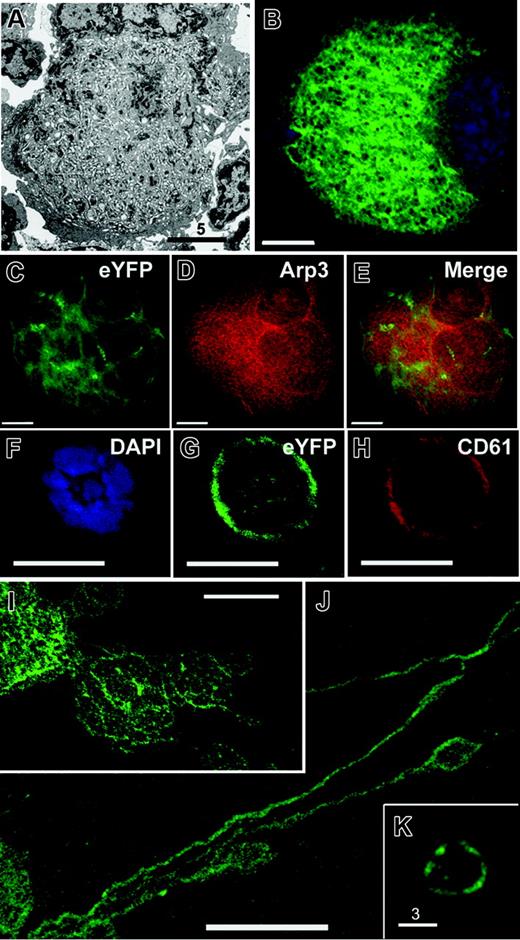 Figure 1. EYFPki MKs serve as reporters for the DMS. (A) Electron micrograph of a representative terminally differentiated MK, displaying abundant DMS that fills the cytoplasm except for the cell cortex. (B) MK derived from EYFPki mice, in which one GPIIb locus is replaced by modified (myristoyl-acceptor) EYFP cDNA, showing a fluorescent internal membrane system that corresponds to the morphology and distribution of the DMS. MK preparations centrifuged on cover slips were examined by fluorescence deconvolution microscopy; a central z-section is depicted. (C-E) Micrograph of a typical young EYFPki MK, with limited surface fluorescence; the cell is outlined (E) with CD61 antibody. (F-H) Costaining of advanced EYFPki MKs with Arp3 antibody (G) shows no correspondence between membranous EYFP signal and diffuse Arp3 staining. (I-K) Micrographs of EYFPki MKs in the process of elaborating proplatelets. Proplatelet membranes are contiguous with MK internal membranes, revealing directly that the latter provide the reservoir for proplatelet formation. (E) Peripheral blood platelets in EYFPki mice show surface fluorescence and further support a DMS origin for blood platelets. Scale bars: A, 5 μm; F-H, 10 μm; K, 3 μm; all others, 15 μm.
