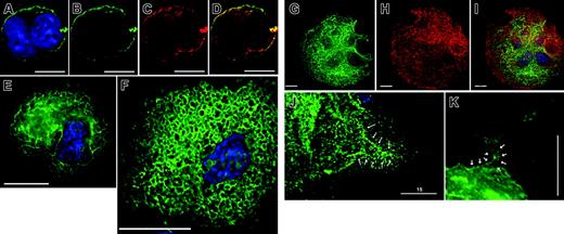 Figure 2. The megakaryocyte DMS accumulates PI-4,5-P2 late in differentiation. MKs were retrovirally transduced with EGFP-tagged pleckstrin homology (PH) domain derived from phospholipase C (PLC)δ1, a specific probe for membrane-associated PI-4,5-P2, and examined by fluorescence deconvolution microscopy. (A-D) In young MKs, only the plasma membrane shows PI-4,5-P2 accumulation, as described for other cells. (A) EYFP merged with nuclear DAPI stain, (B) EYFP alone, (C) CD61 stain alone, (D) merger of EYFP and CD61 signals, showing overlap. (E) In MKs of advanced differentiation, internal membranes stain strongly with PH-PLCδ1. The cell-surface signal is weak, and the predominant staining is internal. (F) Continued cytologic maturation, judged by increased cell size and nuclear complexity, results in elaborate staining of internal membranes, which resemble the DMS as seen by electron microscopy and in EYFPki mice, with virtual loss of cell-surface signal (see also Video S1). (G-I) Costaining of PH(PLCδ1)–EGFP–expressing MKs (G) with CD41 antibody (H), a surface and internal marker of MKs. Double staining (I) highlights the cortical absence of PI-4,5-P2. (J-K) Proplatelets demonstrate PI-4,5-P2 staining in contiguity (arrows) with internal membranes. Scale bars: A-D, 10 μm; E, F, J, K, 15 μm; G-I, 20 μm.