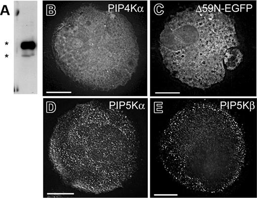 Figure 3. PIP4Kα resides in or near MK internal membranes. (A) Immunoblot of cultured primary mouse MKs with a specific PIP4Kα antibody detects expression of full-length and truncated (Δ59N) splice variants (asterisks). (B) Indirect immunofluorescence with PIP4Kα antiserum. A representative z-section is shown after deconvolution microscopy. (C) EGFP-fused Δ59N-PIP4Kα was forcibly expressed in primary MKs, and serial z-sections from fluorescence deconvolution microscopy revealed internal (not peripheral or nuclear) localization, in a membrane-associated distribution that resembles the DMS. (D-E) Cultured MKs stained with antibodies against type I PIP kinases reveal that the cellular distribution of these enzymes differs from that of PIP4Kα. Single z-sections are shown after deconvolution. Scale bars: 15 μm.