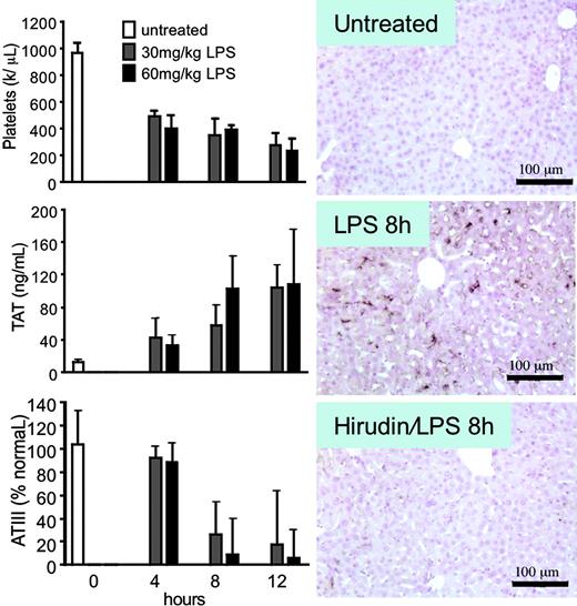 Figure 2. Characterization of disseminated intravascular coagulation after endotoxin. (Left) C57BL/6 females were injected intraperitoneally with 30 (low dose) or 60 (high dose) mg/kg LPS. At the indicated time, blood was collected and platelet counts, TAT levels, and ATIII levels determined (mean ± SD, n = 6). (Right) C57BL/6 females were injected intraperitoneally with 60 mg/kg LPS with or without hirudin (5 mg/kg) treatment as described in “Materials and methods”; untreated control mice were processed in parallel. At 8 hours, mice were perfusion fixed and tissues processed for immunohistochemistry. Antifibrin immunostaining of paraffin sections of liver is shown. Note fibrin deposition in hepatic microvessels of LPS-treated mice and its prevention by hirudin.