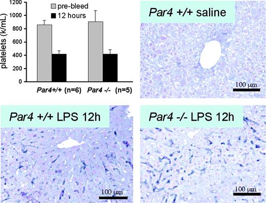 Figure 6. Endotoxin-induced thrombocytopenia in Par4–/– mice. Par4–/– males or littermate control males were injected intraperitoneally with 20 mg/kg LPS. Twelve hours later, mice were bled for platelet counts and perfused for immunohistochemistry. (Top left, mean ± SD) Platelet counts in Par4–/– and littermate controls before and after LPS treatment. (Top right and bottom) Antiplatelet immunostaining of paraffin sections of liver from an LPS-treated Par4–/– or Par4+/+ mouse or a saline-treated Par4+/+ control. Note immunostaining for platelets in microvessels of LPS-treated mice regardless of genotype.