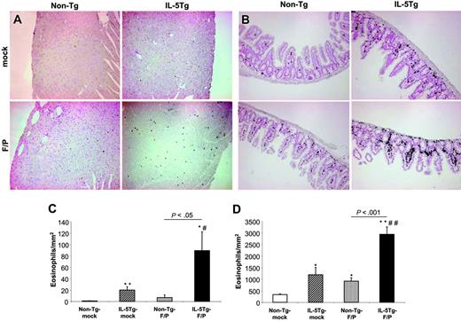 Figure 5. Quantitative histopathologic analysis of the heart and small intestine in the murine eosinophilic disease model induced by F/P fusion gene and IL-5 overexpression. Representative examples (of 3-4 mice per group) of eosinophil content of heart (A) and small intestine (B) of non–Tg-mock, non–Tg-F/P, IL-5Tg-mock, and IL-5Tg-F/P mice are shown in panels A-B. Optical magnifications × 125. Quantitative analysis of the content of MBP+ eosinophils in heart (C) and small intestine (D) of mice depicted in panels A-B was performed. Data are shown as mean ± SD. *P < .05 and **P < .01, compared with non–Tg-mock; #P < .05 and ##P < .01, compared with IL-5Tg-mock.