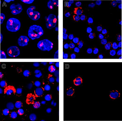 Figure 2. Confocal laser scanning microscopy of NPM1 wt and mutant cells. Cells of the NPM1-wt cell line MV4-11 (A) or mononuclear cells from patient samples with mutations DD-3 (B), DD-4 (C), or DD-1 (D) were stained with a monoclonal antibody against NPM1, Cy-3 labeled with a secondary antibody, and analyzed using confocal laser scanning microscopy. Nuclei were stained with DAPI; original magnification, × 240.