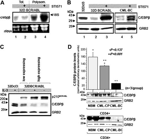 Figure 1. CEBPB mRNA and protein levels in STI571-treated 32D-BCR/ABL cells. (A) Northern blot analysis on total (lanes 1 and 2) or polysome-associated (lanes 3-4) RNA from untreated (lanes 1 and 3) or STI571-treated (2 μM, 12 hours) 32D BCR/ABL cells (lanes 2 and 4). A 500-base segment of the c/ebpβ mRNA 3′UTR was 32P-radiolabeled and used as probe; 28S and 18S are shown as a control of equal RNA loading. (B) Western blot analysis of CEBPB expression in total extracts from 32Dcl3 cells, untreated and STI571-treated (1 μM, 24 hours), 32D-BCR/ABL cells, untreated and STI571-treated (2 μM, 24 hours) mononuclear cells from a CML-BC sample. Western blotting with an anti-GRB2 antibody was used as control of equal loading. (C) Western blot shows CEBPB and tyrosine-phosphorylated BCR/ABL levels in 32Dcl3 cells transduced with MigRI-BCR/ABL and sorted by low and high GFP expression. Anti-GRB2 Western blotting was used as control of equal loading. (D) Histogram (top) and Western blot (bottom, first row) show CEBPB protein levels (expressed as mean ± SE of densitometric units after normalization with GRB2 levels) in the CD34+ fraction from bone marrow of healthy donors (NBM; n = 3), CML-CP (n = 3), and CML-BC (n = 3) patients (NBM versus CML-CP, *P = .137; CML-CP versus CML-BC, **P < .001; t test). The Western blot in the second row shows CEBPB levels in 2 of the 3 NBM, CML-CP, and CML-BC samples still available for a second analysis.