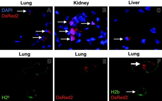 Figure 5. MAPC DLs persist in tissues. Postmortem tissues analysis was performed on 2 to 4 representative animals from each cohort: intravenous delivery with and without NK depletion (B6, Rag2–/–, Rag2/IL-2Rγc–/–), intra-arterial delivery (Rag2/IL-2Rγc–/–), and intravenous or intra-arterial MAPC DLs infused with B10.BR bone marrow into lethally irradiated B6 mice. MAPC DL–derived cells were detected in multiple tissues. Shown here are donor MAPC DL–derived cells in the lung (A), kidney (B), and liver (C) of the B6 mouse, with the highest BLI 30 days after intra-arterial infusion of MAPCs and intravenous infusion of allogeneic bone marrow (original magnification, 200 ×). Donor MAPC DL–derived cells (thin arrows) appeared red as a result of native DsRed2 fluorescence, and nuclei were stained blue with DAPI. Donor MAPC DLs expressed MHC class I in multiple tissues. Shown here are lung cells expressing H2b (green; D) and DsRed2 (red; E) and the superimposition of the green and red pictures (donor MAPC DL cell, thick arrow; recipient cell, thin arrow; original magnification, 400 ×; F).