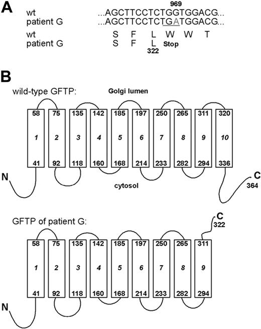 Figure 2. LAD II patient G displays a premature translational termination codon in the GFTP gene. (A) The genomic sequence coding for the GFTP and the respective transcripts obtained from 2 independent RT-PCRs were sequenced and found to bear a G969A nucleotide substitution resulting in a premature stop codon. (B) Predicted topology of wild-type and mutated GFTP. Boxes represent transmembrane domains. The GFTP of LAD II patient G is predicted to be truncated after the ninth transmembrane domain.