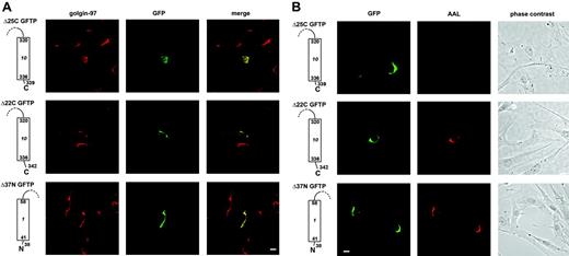 Figure 6. Two missing regions in the patient's GFTP are required for Golgi localization and transport function. The C-terminal deletion mutants Δ25C and Δ22C lack the last 25 and 22 amino acids, respectively. These constructs bear an N-terminal GFP-tag. The N-terminal deletion mutant Δ37N lacks the first 37 amino acids and bears a C-terminal GFP-tag. Only one of 10 transmembrane domains is shown. Fibroblasts of patient G were transfected with the deletion constructs and analyzed for the GFP-tag and golgin-97 (A) or GFP and AAL (B). Construct Δ37N was compared with a C-terminally tagged wild-type GFTP that was functional and located in the Golgi (not shown). One representative experiment of 3 is shown. Bars represent 10 μm.