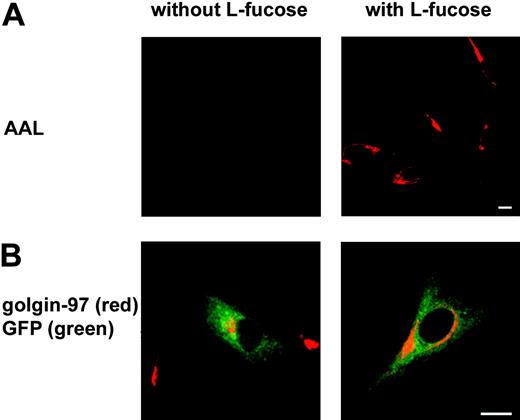 Figure 7. Exogenous fucose can restore fucosylation in cells of the new patient. (A) Fibroblasts derived from patient G were cultured without or with 10 mM l-fucose for 48 hours before they were analyzed for AAL binding. (B) Fibroblasts of patient G were transfected with the GFP-tagged GFTP of this patient and cultured without or with 10 mM l-fucose for 48 hours. Staining of GFP and golgin-97 is shown. One representative experiment of 3 is shown. Bars represent 10 μm.