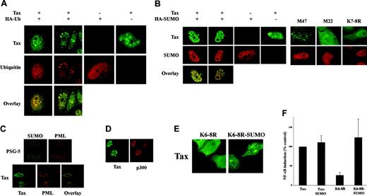 Figure 5. Tax sumoylation is involved in the formation of Tax nuclear bodies and transcriptional activation. (A-B) HeLa cells were transfected with either Tax plasmid together with HA-Ub (A) or HA-SUMO3 (B), and stained by dual immunofluorescence with anti-Tax (green) or anti-HA (red) mabs. (C-D) HeLa cells were transfected with a control plasmid or the Tax plasmid and stained with anti-SUMO, anti-Tax (green), anti-PML, or anti-p300 (red) antibodies. (E) HeLa cells were transfected with Tax K6-8R or Tax K6-8R-SUMO1 plasmids and stained with anti-Tax antibodies. (F) Jurkat cells were cotransfected with the NF-κB-Luc reporter, renilla luciferase, and the plasmid encoding wild-type Tax, Tax-SUMO1, Tax K6-8R, or Tax K6-8R-SUMO1. Activity of the wild-type protein was set to 100%.