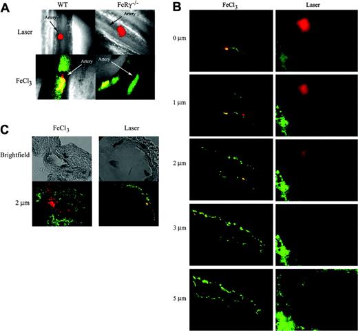 Figure 2. Detection of collagen type I and tissue factor in thrombi after FeCl3 or laser-induced injury. (A) Injuries in wild-type or FcRγ-null mice were induced by application of 10% FeCl3 for 5 minutes or by laser. Platelets were labeled by injection of Alexa 660–conjugated rat anti-CD41 antibody into the circulation prior to injury (red pseudocolor). Collagen was labeled by injection of a rabbit anti–mouse collagen type I antibody (1 μg/g body weight) plus an Alexa 488–conjugated goat anti–rabbit antibody (1 μg/g body weight) prior to injury (green pseudocolor). Merge of platelets and collagen, yellow pseudocolor. (B-C) Cremaster muscles injured by FeCl3 or by laser were isolated and sectioned. Image sections of a thrombus were acquired at 0.5-μm intervals across the vessel diameter perpendicular to the long axis of the vessel by incrementally altering the working distance between the microscope objective and the speciment with a piezo-electric driver.23 (B) Tissue sections were stained with Alexa 660 anti–mouse CD41 antibody, rabbit anti–mouse collagen type I antibody, and an Alexa 488–conjugated goat antirabbit antibody. Platelets are indicated by red pseudocolor; collagen, green pseudocolor; and the merge, yellow pseudocolor. Pictures shown are representative of 4 independent experiments. (C) Tissue sections were stained with Alexa 660–conjugated anti–mouse CD41 antibody, rabbit anti–mouse tissue factor (TF) antibody, and Alexa 488–conjugated goat antirabbit antibody. Platelets are indicated by red pseudocolor; tissue factor, green pseudocolor; and the merge, yellow pseudocolor. Pictures shown are representative of 4 independent experiments.