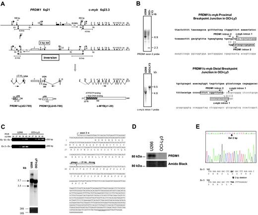 Figure 1. Alterations of PRDM1 and c-myb in the DLBCL cell line OCI-LY3. (A) Diagrammatic representation of chromosomal inversion between the PRDM1 and c-myb loci and alterations in their transcript and protein products. Boxes indicate exons, with coding frame in black. The 5′ exons derived from the alternate promoters of PRDM1 and c-myb are denoted as 1β. The 5′ and 3′ breakpoints are shown by block arrows, and their positions relative to the 3′ ends of PRDM1 exon 2 and c-myb exon 1 are indicated. The expected sizes of the germ line and rearranged EcoRI fragments spanning the breakpoints and detected by Southern blotting (panel B) are marked. The cryptic exon located approximately 21 kb downstream of PRDM1 exon 2, as well as the c-myb cryptic exon 1, are indicated by asterisks. The 2-bp frameshift deletion (del) and sites of premature translation termination (UGA) are shown. Structures of the truncated PRDM1 and c-MYB are depicted with their relevant functional domains. PR indicates PR domain; ZnF, zinc fingers; ++, basic domain; —, acidic domain; S/T, serine/threonine-rich region. (B) Gene rearrangement and junction sequences at the proximal and distal breakpoints. Left: Southern blot analysis of EcoRI-digested genomic DNA detected gene rearrangement using the PRDM1 exon 2 probe (top) and the c-myb intron 1 probe (bottom). The germ line bands detected in U266 are absent in OCI-Ly3, consistent with deletion of the wild-type allele. Right: Junction sequences for the proximal breakpoint (top) and the distal breakpoint (bottom). Putative breakpoints are indicated by arrowheads. The germ line PRDM1 intron 2 and c-myb intron 1 sequences normally present adjacent to the breakpoints also are shown. The putative 5′ end of the PRDM1 intron 2 sequence translocated next to c-myb intron 1 and the putative 3′ end of the c-myb intron 1 sequence translocated next to PRDM1 intron 2 are marked by open and filled boxes, respectively. Nucleotides that appear to be duplicated next to the breakpoints are indicated in italics. The nucleotide at the proximal breakpoint junction that differs from the germ line sequence (g-to-c change) is underlined. (C) PRDM1 RNA expression analysis in OCI-Ly3. Top left: PRDM1α and PRDM1β transcripts were analyzed by RT-PCR using primers specific to exon 2 and exon 4, or exon 1β and exon 4, respectively. In OCI-LY3, no PCR products could be obtained using the exon 2/exon 4 primer pair as a result of chromosomal inversion (panel A), while normal splicing occurs between exon 1β and exon 4. Bottom left: A Northern blot was hybridized with a PRDM1 exon 4 to 7 cDNA probe, which detected both PRDM1α and PRDM1β transcripts in U266, but only PRDM1β mRNA in OCI-Ly3. The smaller (∼3.5 kb) transcripts present in OCI-Ly3 most likely are derived from alternative polyadenylation, as described previously.1 Right: Sequence of fusion transcripts consisting of PRDM1 exon 2 spliced to a cryptic exon approximately 21 kb downstream using consensus splice donor and acceptor sites (italics). These transcripts code for the first 61 amino acids of PRDM1α followed by a novel 36 amino-acid peptide sequence (italics). The consensus polyadenylation signal (AATAAA) is underlined. (D) Western blot analysis of PRDM1 in OCI-Ly3 and U266 using antibody to the N terminus of PRDM1. PRDM1α was detected in U266 but not in OCI-Ly3. Amido-black staining of the blot served as loading control. (E) Frameshift mutation of PRDM1. The sequence chromatogram of OCI-Ly3 genomic DNA shows a 2-bp deletion that leads to a frameshift and premature translation termination (bold). The numbering of the nucleotides corresponds to the nucleotide number starting from the 5′ end of exon 5.