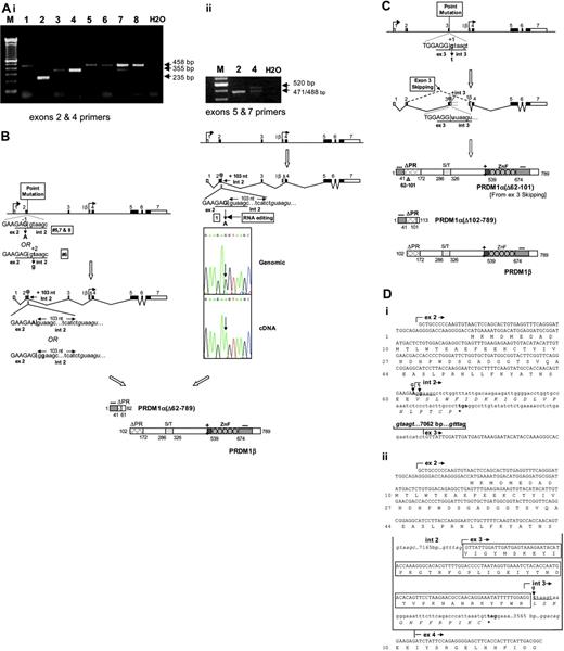 Figure 3. Clonal mutations of PRDM1 in DLBCL clinical cases. (A) Expression analysis of PRDM1 transcripts in DLBCL by RT-PCR. (i) PCR amplification was performed on cDNAs using specific primers located in exons 2 and 4 (Table 1), which normally generate a 355-bp band upon agarose-gel electrophoresis. PCR amplicons of altered sizes were seen in most cases (1, 2, 5, 6, 7, 8), indicative of splicing aberrations. Note the absence of normal-sized bands in these lymphomas, which are consistent with the lack of expression of the normal PRDM1 transcripts. The relatively weak normal-sized bands seen in tumor no. 7 may be due to the presence of contaminating normal cells that express PRDM1. (ii) Using primers spanning exons 5 and 7, PCR amplification generated 2 major bands of approximately equal intensity in case no. 4, one normal-sized (471 bp), and the other larger than normal (520 bp). Upon sequencing, the normal-sized band is found also to contain a small amount of a slightly larger product (488 bp) in addition to the normal-sized product. The presence of abnormally sized products indicates splicing aberrations. (B) Splicing aberrations associated with point mutations at the exon 2/intron 2 junction. A schematic diagram illustrating splicing abnormalities in tumors 5, 6, 7, and 8. Point mutations at the consensus splice donor sequence (underlined) at the exon 2/intron 2 junction (G → A at position –1 in tumors 5, 7, and 8; t → g at position +2 in tumor no. 6) are indicated in bold. Right: Diagrammatic depiction of splicing abnormalities in tumor no. 1 as a result of RNA editing. Point mutation at the consensus splice donor sequence (underlined) at the exon 2/intron 2 junction (G → A at position –1) is indicated, along with the sequence chromatogram of cDNA showing the editing G-to-A conversion absent in genomic DNA. The cryptic splice donor site actually used in the tumors is in italics. The 103-bp intron 2 sequence inserted in the tumor transcripts and the resulting premature translation termination are marked. The predicted structures of PRDM1α and PRDM1β derived from the respective transcripts are shown, along with their functional domains. (C) A schematic diagram illustrating RNA splicing aberrations associated with point mutation at the exon 3/intron 3 junction, as seen in tumor no. 2. Point mutation (g → t) in position +1 of the consensus splice donor sequence (underlined) is shown in bold. Exon 3 skipping and retention of intron 3 sequence (of unknown length) are indicated. The former splicing abnormality causes an internal deletion in the PR domain, and the latter results in premature translation termination. The predicted structures of PRDM1α and PRDM1β are shown, along with their functional domains. (D) (i) cDNA nucleotide sequence of tumor transcripts retaining intron 2 sequence. The point mutations that inactivate the consensus splice donor site (underlined) are indicated in bold (G → A for tumors 1, 5, 7, and 8; t → g for tumor no. 6). The intron 2 cryptic splice donor site and the splice acceptor site at the intron 2/exon 3 junction used in the tumors are in italics. The retained 103-bp intron 2 sequence and the distance between its 3′ end and the 5′ end of exon 3 (7062 bp) is indicated. The premature translation termination codon UGA is in bold, and the novel peptide sequence predicted from translation of the intron 2 sequence is shown in italics. (ii) Partial cDNA nucleotide sequence showing exon 3 skipping or intron 3 sequence retention in transcripts from tumor no. 2. The point mutation (g → t) at the first nucleotide of intron 3 that inactivates the consensus splice donor site (underlined) is shown. The splice donor and acceptor sites used in splicing between exon 2 and exon 4 (or exon 3) are in italics, and the exon 3 nucleotide sequence and encoded amino acids that are internally deleted due to exon 3 skipping are boxed. Sizes of intron 2 and 3 are shown. The intron 3 sequence of indeterminate length retained in some of the tumor transcripts is partially shown, including the premature termination codon (in bold). The novel peptide sequence translated from the intron 3 sequence is shown in italics.