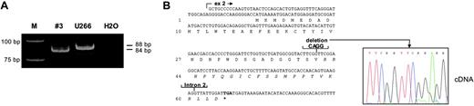 Figure 5. Frameshift mutation in exon 2. (A) RT-PCR analysis of exon 2 sequence in tumor no. 3 (see Table 1 for primers). PCR products were resolved on a 10% polyacrylamide gel. The PCR product derived from the tumor is slightly smaller than that from U266. (B) Sequence chromatogram of cDNA derived from tumor no. 3 showed 4-bp deletion, which results in frameshift and premature translation termination. Note absence of expression of a normal PRDM1 allele in both (A) and (B).