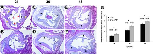 Figure 3. Plaque formation in aortic sinuses of mice. H&E stains of aortic sinuses from L–/–/A–/– (A,C,E) and L–/–/A–/–/FG–/– (B,D,F) mice at 24, 36, and 48 weeks of age. Red arrows indicate the leaflets of aortic valves; yellow arrows, the vascular wall of aorta; and black arrows, the plaques. Original magnification, × 40. (G) Plaque sizes in aortic sinuses of L–/–/A–/– (▪) and L–/–/A–/–/FG–/– (▦) mice, as revealed by morphometric analysis of H&E-stained slides. *P < .05.