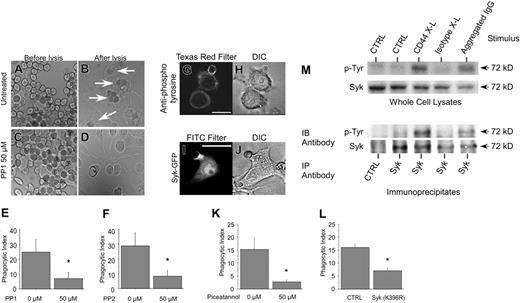 Figure 4. Src family kinases and Syk are involved in CD44-mediated phagocytosis. (A-D) Binding and uptake of CD44 Ebabs by macrophages was assessed quantitatively by light microscopy using a 63 ×/0.90 liquid-immersion objective lens (Leica Microsystems). Digital images were acquired through a Qimaging Retiga EX camera (Qimaging, Burnaby, Canada) and processed using OpenLab 3.4 software (Improvision, Lexington, MA). This figure illustrates the high level of both adhesion (tethering) and engulfment (white arrows) of CD44 Ebabs in the control assay (A-B) without specific inhibitor, whereas CD44 Ebabs preincubated with 50 μM PP1 Src-kinase pharmacologic inhibitor (C-D) were tethered but not engulfed. (E-F) Histograms illustrate the efficiency of phagocytosis of RAW macrophages preincubated with 0 or 50 μM PP1 or PP2 and subsequently fed CD44 Ebabs as prey. *Different from 0 μM inhibitor, P < .05, mean ± SE of 4 separate experiments. (G-H) Confocal fluorescent and bright field images of RAW macrophages labeled with antiphosphotyrosine antibodies during phagocytosis of CD44 Ebabs. The solid line represents 10 μm. (I-J) Confocal fluorescent and bright field images of RAW cells transfected with Syk-GFP and presented with CD44 Ebabs. Solid line represents 10 μm. (K) Efficiency of phagocytosis of CD44 Ebabs preincubated with 0 or 50 μM Syk inhibitor piceatannol. *Different from 0 μM piceatannol; P < .05, mean ± SE of 4 separate experiments. (L) Efficiency of phagocytosis of CD44 Ebabs by RAW cells expressing GFP-tagged Syk (K396R) dominant-negative fusions compared with nonexpressing control cells. *Different from nontransfected controls; P < .01, mean ± SE of 4 separate experiments. (M) Syk phosphorylation is increased in response to antibody crosslinking of CD44 as determined by Western blot analysis of whole-cell lysates (top) and Syk immunoprecipitates (bottom). Images are representative of 3 independent experiments. IB indicates immunoblot; IP, immunoprecipitation.
