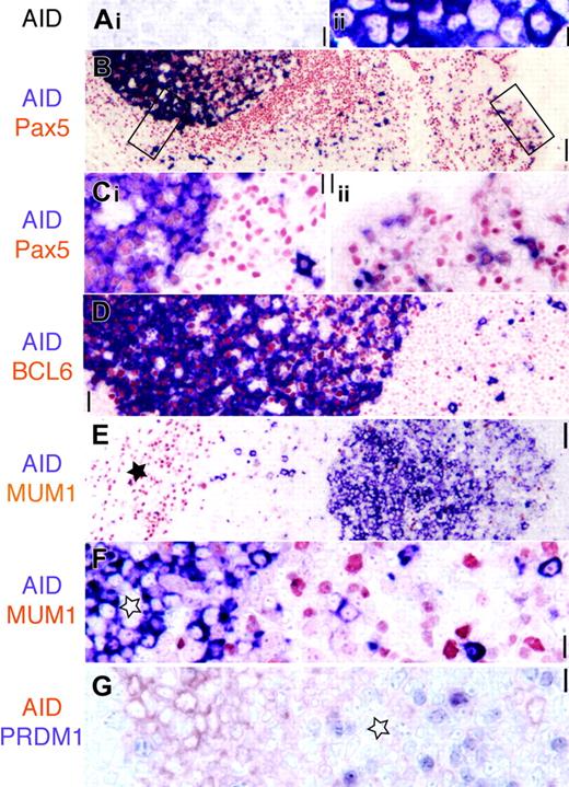 Figure 1. AID is expressed in Pax5+ GC and extrafollicular B cells. (A) AID transfectants (ii, purple) but not mock-transfected cell lines are stained by the EK2-5G9 antibody. Original magnification × 40. (B) Low-power image (original magnification × 10) of AID (purple) and panB cell Pax5 (red) in tonsil. The epithelial surface is on the right. Two rectangles indicate areas magnified in panel C. (Ci) AID stains Pax5+ GC and extrafollicular large blasts. (Cii) Subepithelial Pax5+ B cells are AID+. Original magnification × 40. (D) AID+ GC cells are BCL6+ (red), while extrafollicular AID+ are BCL6–. Original magnification × 20. (E) Low-power image (original magnification × 10) of AID (purple) and MUM1 (red). The star marks plasma cell collection in the septa. AID+ GC on the right is MUM1 negative. (F) High-power image of a MUM1–AID+ GC (star) and MUM1– extrafollicular blasts. Original magnification × 40. (G) AID+ centroblasts (red) are PRDM1– (purple). These latter are found in the AID– light zone (star). Original magnification × 40. Scale bar: 1 μmat × 40, 4 μmat × 10, and 10 μmat × 4.