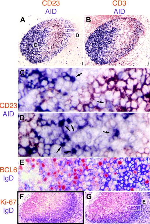 Figure 4. AID is expressed in the dark zone and the outer zone in GC. (A) AID (purple) and CD23 (red) are mutually exclusive in the GC. Note weakly CD23+ mantle zone. Original magnification ×4. (B) CD3+ T cells (red) are abundant in the AID+ outer zone at the right edge of the GC. Original magnification ×4. (C-D) The 2 white rectangles shown in panel A are magnified. In panel C, the basal light zone is empty, flanked by AID+ dark zone on top left, containing a single nAID+ cell (arrow) and the CD23+ apical light zone in the bottom right, in which a weakly AID+ nucleus contact CD23+ FDC (arrow). In panel D, the outer zone is magnified, containing numerous nAID+ cells (arrows). Original magnification ×40. Note the CD23+ mantle zone cells in the lower-right corner. (E) High-power detail of the area boxed in panel G, showing IgD strongly positive mantle zone cells on the right (purple), and double BCL6 (red) and IgD weakly positive cells of the outer zone, in the center. (F-G) Low-power images of serial sections stained for IgD (purple) and Ki-67 (F) or BCL6 (G). Note the double-positive cells under the IgD+ mantle zone. Scale bar: 1 μmat ×40, 4 μmat ×10, and 10 μmat ×4.
