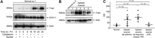 Figure 1. Increased T-bet levels in T cells from patients with aplastic anemia. (A) Cytoplasmic and nuclear extracts from healthy volunteers were analyzed in immunoblots for T-bet expression. T-bet could be detected only in the nucleus of normal T cells after at least 18 hours of stimulation with PMA and ionomycin. STAT1 served as a control to show differences in cytoplasmic-nuclear localization. Actin was used to show equal loading of the samples. (B) Unstimulated nuclear extracts from healthy volunteers and aplastic anemia patients were analyzed for T-bet expression. All patients' samples were run side-by-side with healthy donors' samples. Patients had significantly increased levels of T-bet compared with controls. (C) Densitometric intensity of immunoblots results from all the subjects studied. The results obtained from unstimulated T-cell T-bet expression between healthy individuals and aplastic anemia patients were highly significant (P < .001). Horizontal lines indicate mean values.