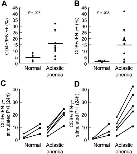 Figure 4. T-bet levels correlate with intracellular IFN-γ levels in aplastic anemia patients. (A-B) We examined the intracellular IFN-γ levels using flow cytometric analysis in PBMCs from aplastic anemia patients (n = 10) and healthy controls (n = 5). CD4+ and CD8+ T cells from aplastic anemia patients showed increased intracellular levels of IFN-γ compared with controls. The increased expression of intracellular IFN-γ in aplastic anemia patients correlated with increased T-bet protein levels observed in the same patients. The differences in the percentages of double-positive CD4+/IFN-γ+ and CD8+/IFN-γ+ cells between healthy controls and patients examined were significant (P = .025 and P = .035, respectively). (C-D) CD4+ and CD8+ T cells from aplastic anemia patients showed increased intracellular IFN-γ levels after stimulation for 24 hours with PMA and ionomycin (P+I). The graphs show the percent of CD4+/IFN-γ and CD8+/IFN-γ cells before (•) and after (▪) stimulation. The differences in stimulated cells were also significant. Horizontal lines represent mean values.