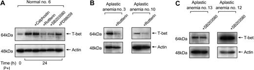Figure 6. PKC-θ participates in the inducible expression of T-bet. (A) Calphostin C (0.05 μM) and rottlerin (30 μM) were used for the inhibition of PKC and PKC-θ, respectively. SB203580 (10 μM) and PD98059 (50 μM) were used for the inhibition of the p38 and the MEK/Erk kinase pathway, respectively. Normal T cells were treated with these inhibitors prior to stimulation with PMA and ionomycin followed by preparation of nuclear extracts. The nuclear extracts were used in immunoblot experiments for T-bet expression. In normal T cells, calphostin did not have any effect on T-bet expression, while rottlerin inhibited T-bet protein levels by 50%. SB203580 and PD98059 decreased T-bet levels by 35% and 10%, respectively. The results shown here are representative of 5 different experiments performed. (B) When T cells from aplastic anemia patients were treated with rottlerin, T-bet expression was decreased by 50%. (C) SB203580 showed a mean 15% decrease in T-bet protein levels in aplastic anemia patients.