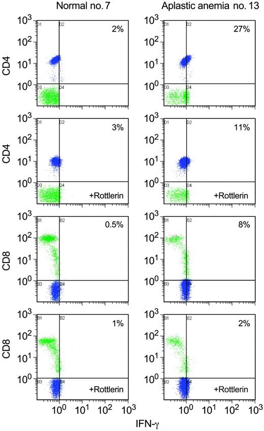 Figure 7. Rottlerin decreases IFN-γ levels in aplastic anemia T cells. We examined the effect of rottlerin on intracellular IFN-γ levels using flow cytometric analysis in PBMCs from aplastic anemia patients (n = 4). In patients with increased IFN-γ levels (3 of 4 patients examined), rottlerin diminished IFN-γ by approximately 50%. A representative experiment of all patients and controls examined is shown. Blue indicates CD4+; green, CD8+.